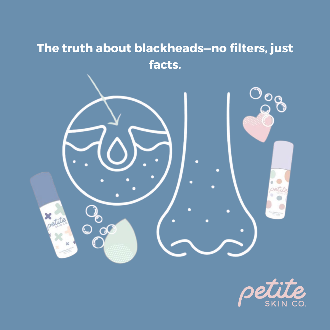 The Ultimate Blackhead Guide: A 3-Step Routine for Pre-Teens & Kids' Skin