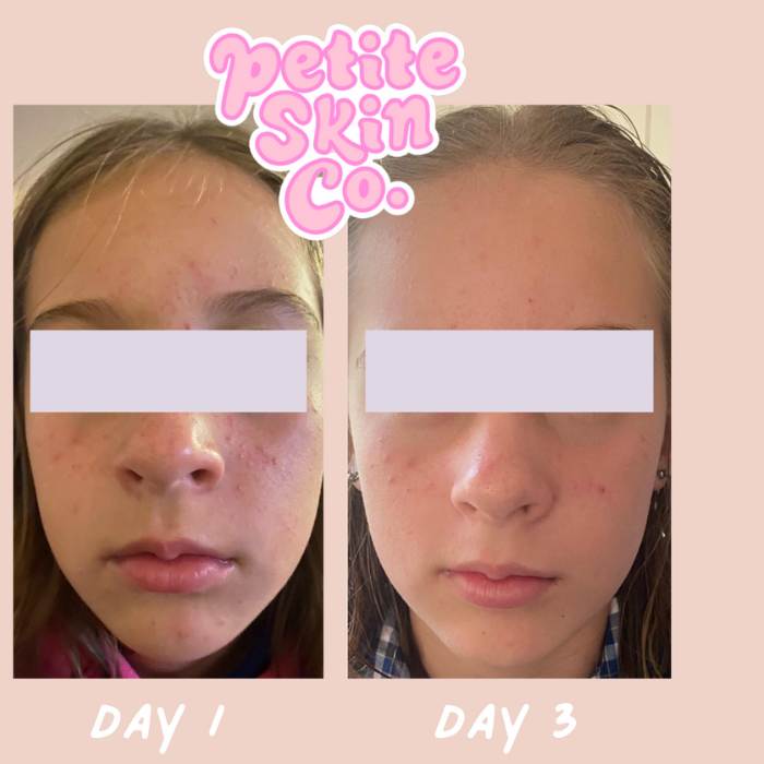 When is the right time to start a skincare routine? - Petite Skin Co.