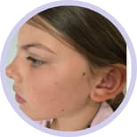 Dry & Dehydrated Skin