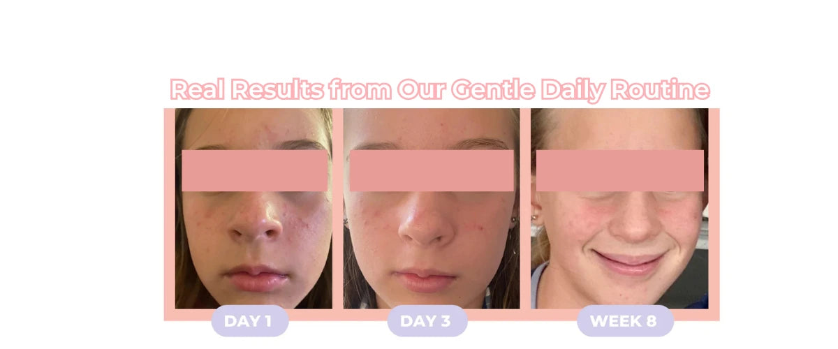 A girl Day 1, Day 3 and Week 8