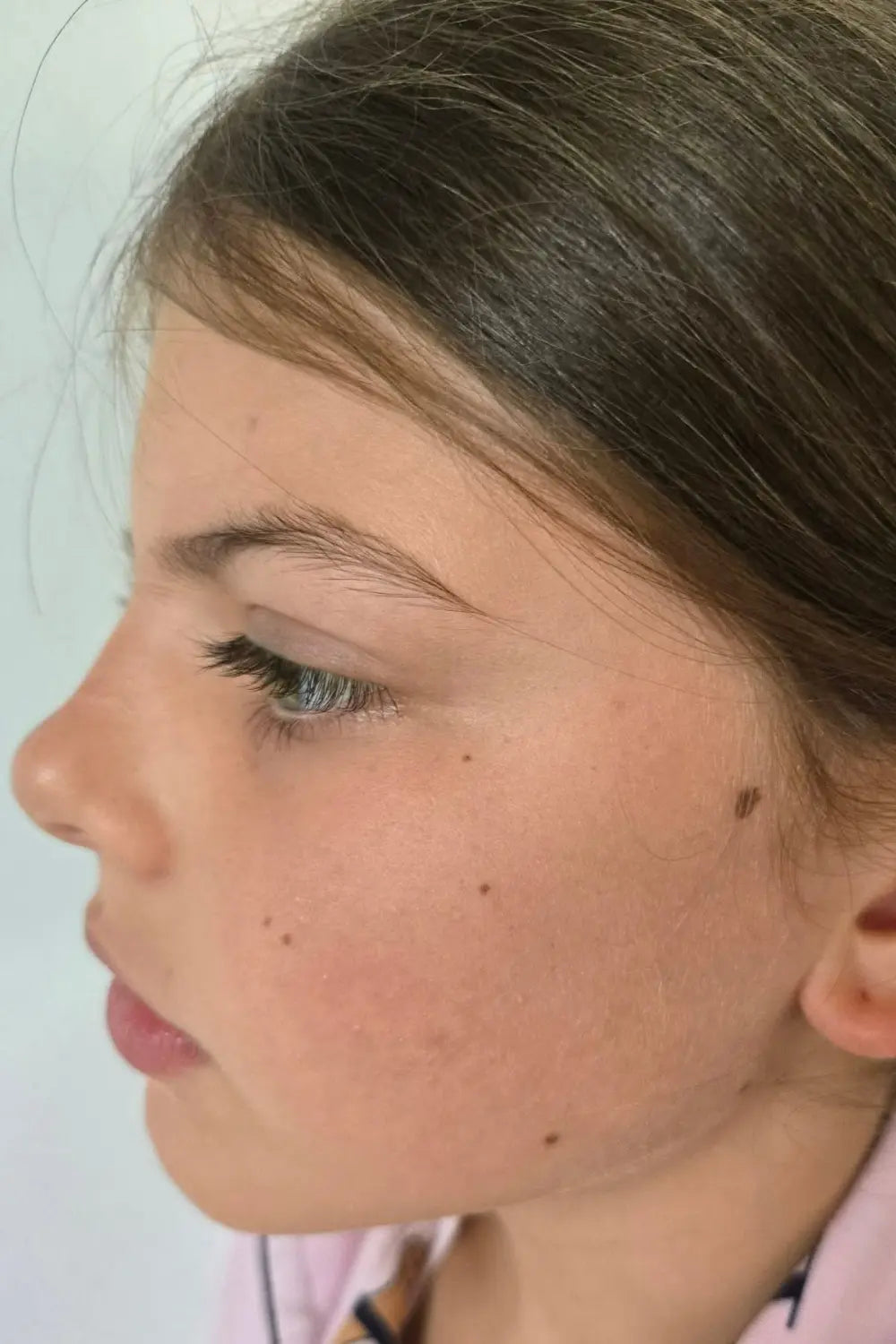 Close-up profile of a young girl with clear, natural skin, showcasing the gentle, Australian made skincare focus designed for the biology of 7 to 14 year olds.