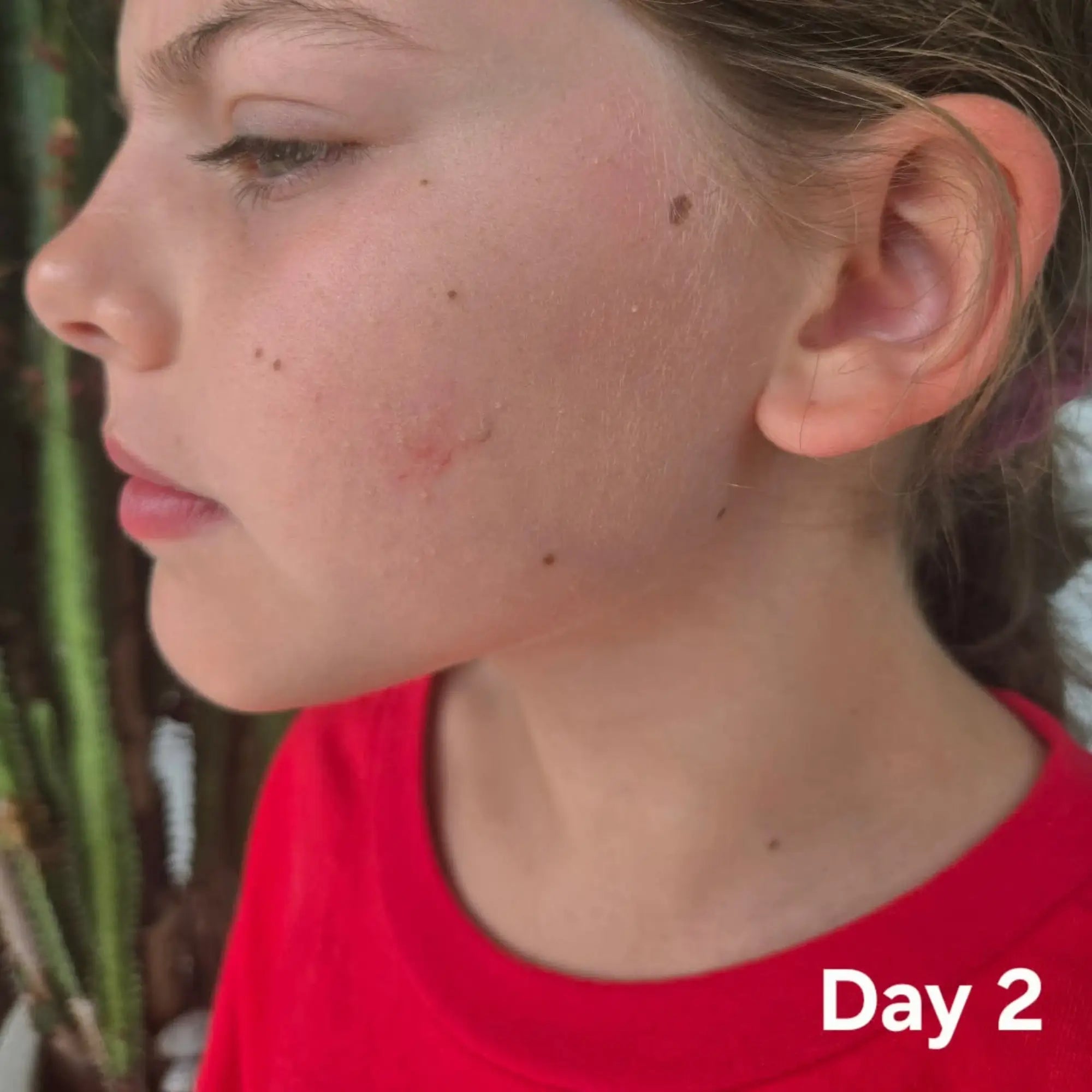 Daily Defence Skincare Kit