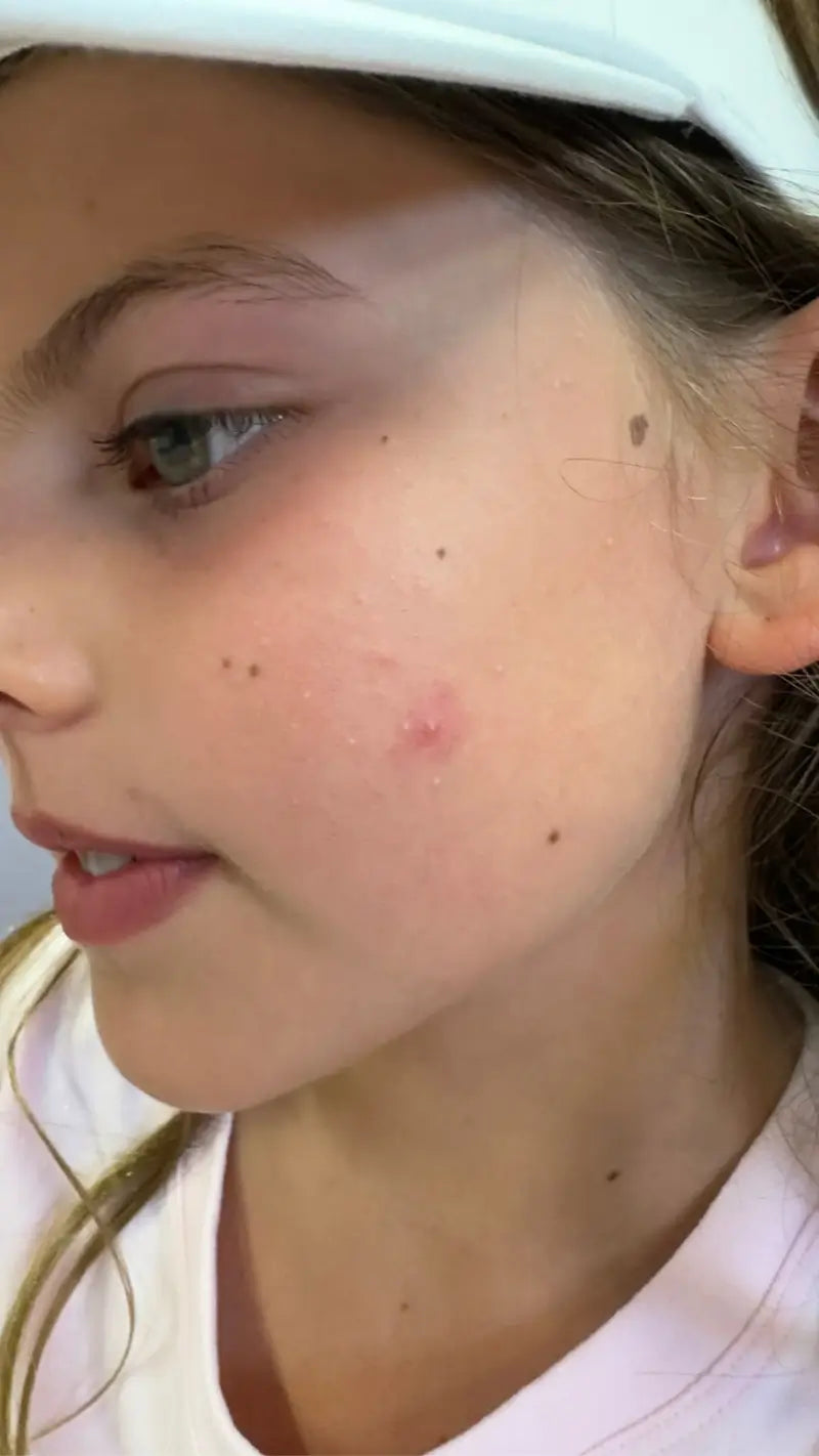 Close-up of a person wearing a white cap and light pink shirt.